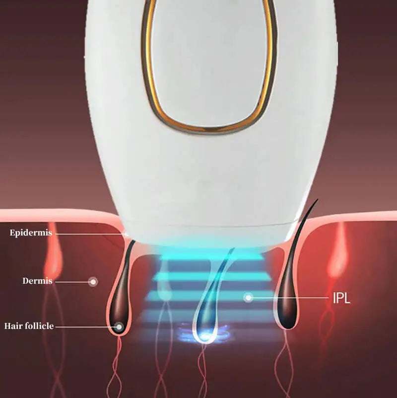 Appareil d’Épilation IPL : 500 000 Flashs pour une Peau Douce et Durable à Domicile