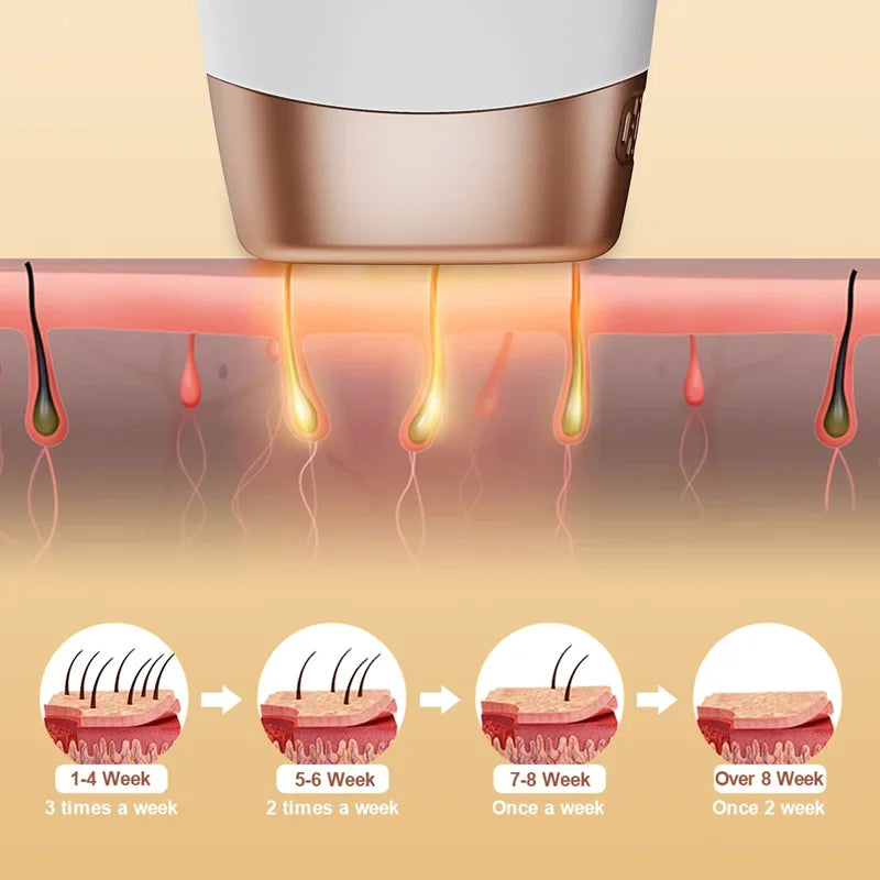 Épilateur Laser Permanent 999 999 Flashs – Épilation Indolore et Durable à Domicile pour Femmes