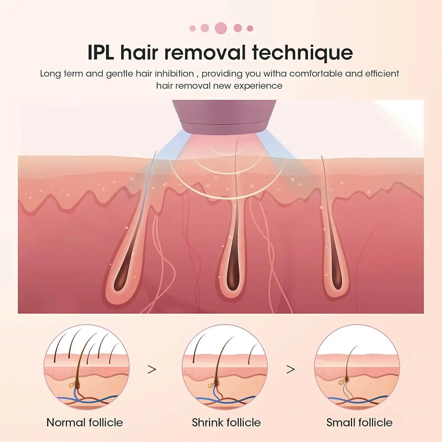 Appareil d’Épilation IPL : 500 000 Flashs pour une Peau Douce et Durable à Domicile