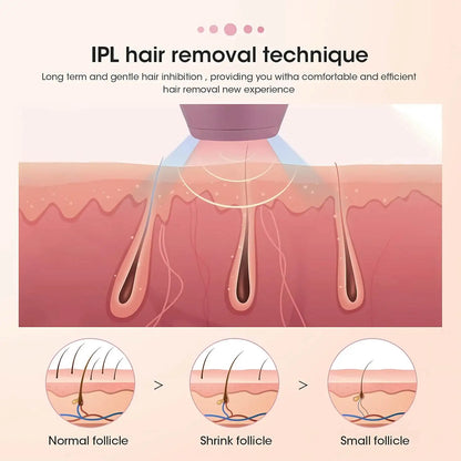 Appareil d’Épilation IPL : 500 000 Flashs pour une Peau Douce et Durable à Domicile